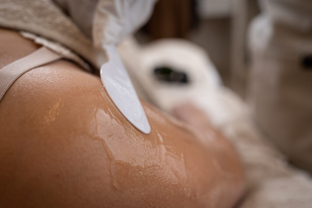 Insmeren van de huid met een gel voor het laser ontharen bij SkinSmile in Voorschoten of Zwijndrecht