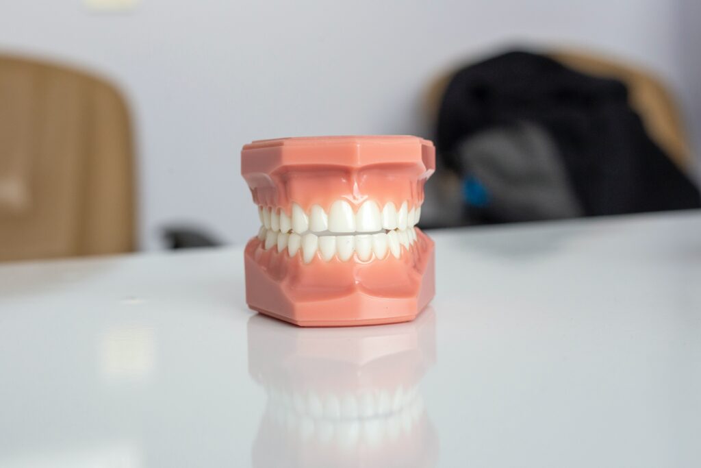 Kunstgebit met voorbeeld tanden voor het tanden bleken bij SkinSmile in Zwijndrecht en Dordrecht