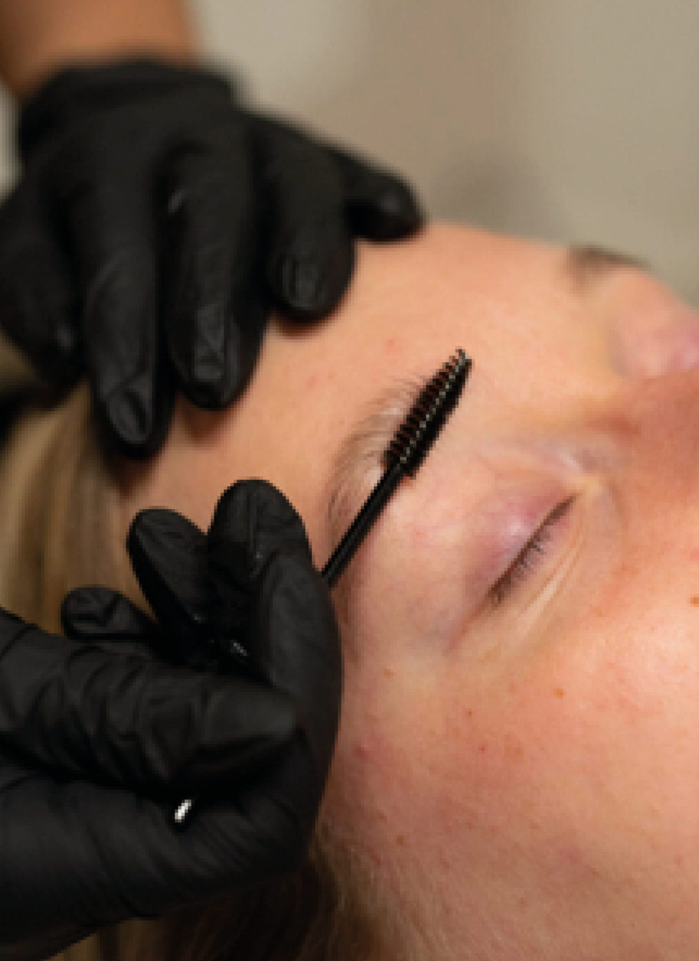 Behandeling voor wenkbrauwen