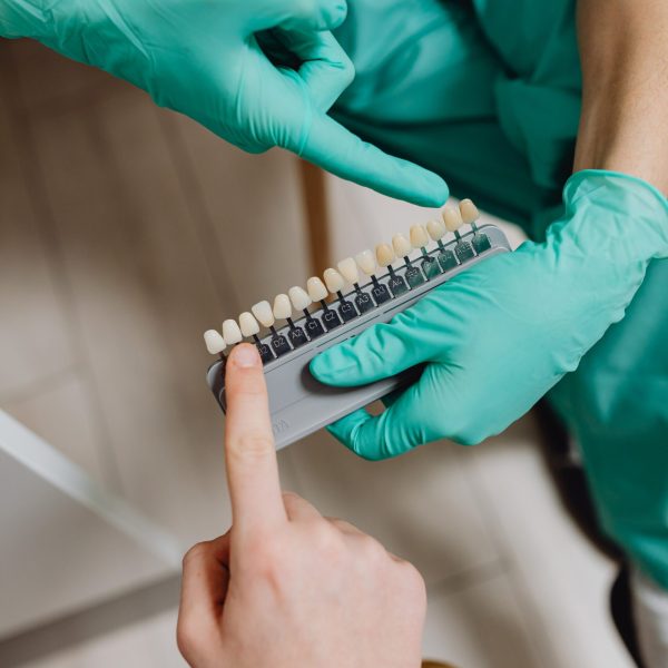 Voorbeelden van verschillende teinten voor het tanden bleken